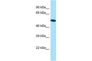 WB Suggested Anti-ACTR6 Antibody Titration: 1. (ACTR6 anticorps  (C-Term))