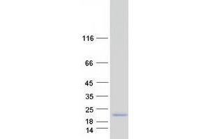 Validation with Western Blot