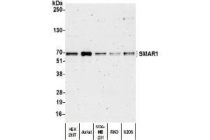 Western Blotting (WB) image for anti-Protein BANP (BANP) (C-Term) antibody (ABIN7453906)