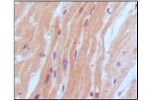 Immunohistochemical analysis of paraffin-embedded human normal myocardium, showing cytoplasmic localization using BNP2 mouse mAb with DAB staining. (BNP anticorps)