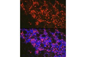 Immunofluorescence analysis of mouse bone marrow cells using FADD Rabbit pAb (ABIN7267137) at dilution of 1:100 (40x lens). (FADD anticorps)