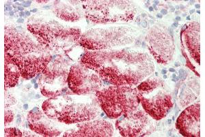 Rabbit Anti-Gyg antibody  Formalin Fixed Paraffin Embedded Tissue: Human Tonsil, Skeletal Myocytes Primary antibody Concentration: 1:100 Secondary Antibody: Donkey anti-Rabbit-Cy3 Secondary Antibody Concentration: 1:200 Magnification: 20x Exposure Time: 0. (GYG anticorps  (C-Term))