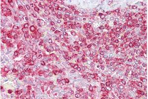 Immunohistochemistry with Spleen tissue at an antibody concentration of 5µg/ml using anti-GCLC antibody (ARP54577_P050)