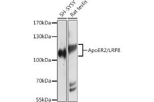 Western blot analysis of extracts of various cell lines, using ApoER2/ApoER2/LRP8 antibody (ABIN6134224, ABIN6143337, ABIN6143338 and ABIN6214801) at 1:1000 dilution. (LRP8 anticorps  (C-Term))
