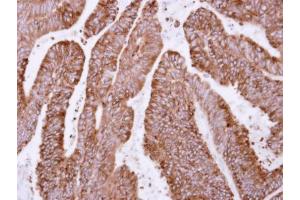 anti-O-Sialoglycoprotein Endopeptidase (OSGEP) antibody