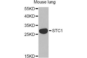 Western blot analysis of extracts of mouse lung, using STC1 Antibody (ABIN2560198) at 1:1000 dilution. (Stanniocalcin 1 anticorps)
