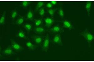 Immunofluorescence analysis of A549 cells using POLD1 Polyclonal Antibody (POLD1 anticorps)