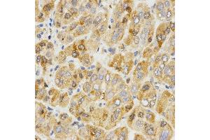 Immunohistochemistry (IHC) image for anti-Tropomyosin-2 (TPM2) antibody (ABIN3017365)