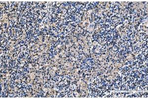 IHC analysis of CD9 using anti-CD9 antibody (ABIN7600001). (CD9 anticorps  (AA 139-192))