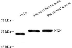 Western blot analysis of NXN (ABIN7074916),at dilution of 1: 1000 (NXN anticorps)