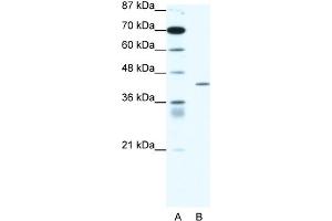 WB Suggested Anti-PPARD Antibody Titration:  1. (PPARD anticorps  (Middle Region))