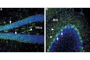 Expression of Glucose transporter 3 in mouse hippocampus and cerebellum - Immunohistochemical staining of perfusion-fixed frozen mouse brain sections with Anti-GLUT3 (extracellular) Antibody (ABIN7043696, ABIN7044485 and ABIN7044486), (1:200), followed by goat anti-rabbit-AlexaFluor-488.