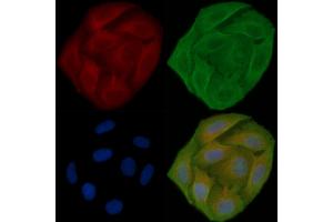 ABIN6257703 and ABIN6273923 staining Hela cells(30 min of UV treatment) by IF/ICC. (CCKBR anticorps  (N-Term))