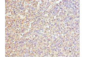 Immunohistochemistry of paraffin-embedded human spleen tissue using ABIN7168685 at dilution of 1:100 (FRZB anticorps  (AA 166-325))