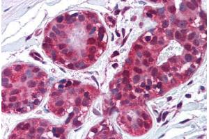 Human Breast (formalin-fixed, paraffin-embedded) stained with TIMP2 antibody ABIN214221 at 10 µg/ml followed by biotinylated anti-mouse IgG secondary antibody ABIN481714, alkaline phosphatase-streptavidin and chromogen. (TIMP2 anticorps)