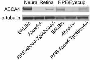 Immunoblot of retina and RPE homogenates from BALB/c, Abca4−/−, and RPE-Abca4-Tg/Abca4−/− mice (all albino) reacted with antisera against ABCA4 or alpha-tubulin. (ABCA4 anticorps  (AA 2250-2263))