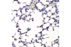 Immunohistochemistry of paraffin-embedded mouse lung using INTS6 Antibody. (INTS6 anticorps  (AA 1-280))