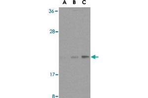 Western blot analysis of BAX in HL-60 cell lysates with BAX polyclonal antibody  at (A) 1, (B) 2, and (C) 4 ug/mL . (BAX anticorps  (N-Term))