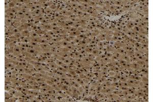 ABIN6273026 at 1/100 staining Mouse liver tissue by IHC-P. (YTHDF2 anticorps  (Internal Region))