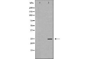 Western blot analysis of Hela whole cell lysates, using TK1 Antibody. (TK1 anticorps  (N-Term))