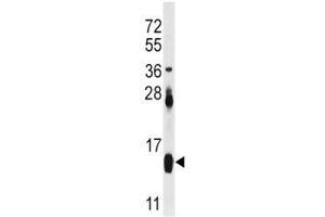Western blot analysis of FABP4 antibody and mouse heart tissue lysate.