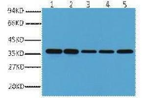 Western Blotting (WB) image for anti-Glyceraldehyde-3-Phosphate Dehydrogenase (GAPDH) antibody (ABIN3178582) (GAPDH anticorps)