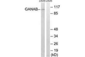 Western blot analysis of extracts from LOVO cells, using GANAB Antibody. (GANAB anticorps  (AA 242-291))