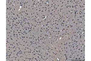 IHC analysis of hnRNP U/p120/HNRNPU using anti-hnRNP U/p120/HNRNPU antibody (ABIN7600979).