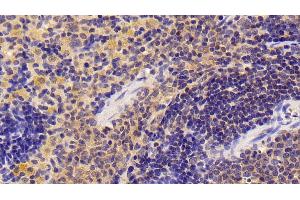 Detection of NFkB in Rat Spleen Tissue using Polyclonal Antibody to Nuclear Factor Kappa B (NFkB)