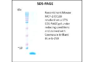 SDS-PAGE (SDS) image for Chemokine (C-C Motif) Ligand 8 (CCL8) (Active) protein (ABIN5509444)
