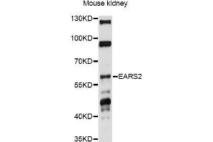 anti-Glutamyl-tRNA Synthetase 2 Mitochondrial (EARS2) antibody