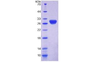 SDS-PAGE (SDS) image for Retbindin (RTBDN) (AA 32-247) protein (His tag) (ABIN4990677)