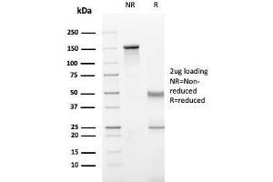 SDS-PAGE Analysis Purified Perforin-1 Monospecific Mouse Monoclonal Antibody (PRF1/2470). (Perforin 1 anticorps  (AA 413-552))