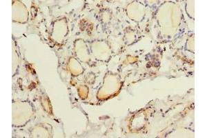 Immunohistochemistry of paraffin-embedded human thyroid tissue using ABIN7153260 at dilution of 1:100 (FYCO1 anticorps  (AA 2-255))