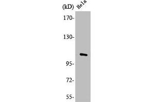 Western Blot analysis of HepG2 cells using LZK Polyclonal Antibody