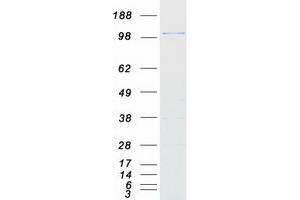 Validation with Western Blot