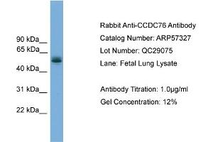 WB Suggested Anti-CCDC76  Antibody Titration: 0. (CCDC76 anticorps  (N-Term))