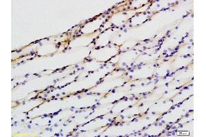 Formalin-fixed and paraffin embedded rat kidney labeled with Anti-beta Defensin 1 Polyclonal Antibody, Unconjugated  at 1:200 followed by conjugation to the secondary antibody and DAB staining.
