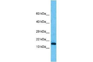Host:  Rabbit  Target Name:  PNKD  Sample Type:  HepG2 Whole Cell lysates  Antibody Dilution:  1.