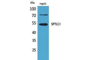 Western Blotting (WB) image for anti-serine Palmitoyltransferase, Long Chain Base Subunit 1 (SPTLC1) (C-Term) antibody (ABIN3187765) (SPTLC1 anticorps  (C-Term))