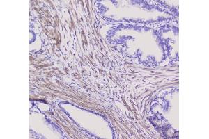 IHC analysis of NSE using anti-NSE antibody (ABIN6719549). (ENO2/NSE anticorps)