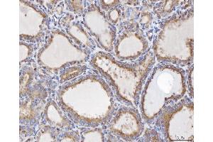 IHC analysis of TTC11/FIS1 using anti-TTC11/FIS1 antibody (ABIN7600321). (Fission 1 anticorps  (AA 18-152))