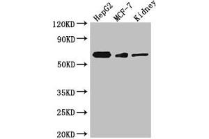 Western Blot Positive WB detected in: HepG2 whole cell lysate, MCF-7 whole cell lysate, Mouse kidney tissue All lanes: Vangl2 antibody at 3 μg/mL Secondary Goat polyclonal to rabbit IgG at 1/50000 dilution Predicted band size: 60 kDa Observed band size: 60 kDa