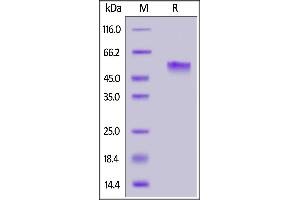 Human PVRIG, Mouse IgG2a Fc Tag on  under reducing (R) condition.