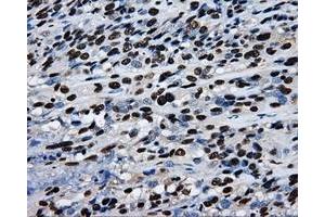 Image no. 10 for anti-Replication Protein A2, 32kDa (RPA2) antibody (ABIN1500733)