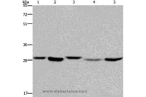 Western blot analysis of 293T, MCF-7 and PC3 cell, human fetal liver tissue and Hela cell, using ECHS1 Polyclonal Antibody at dilution of 1:300 (ECHS1 anticorps)