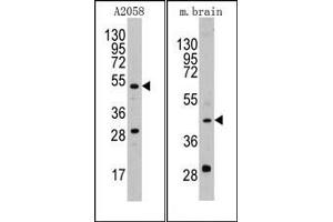 Image no. 1 for anti-Plasminogen Activator, Urokinase (PLAU) (AA 68-98), (N-Term) antibody (ABIN2853629)