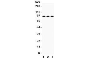 Western blot testing of TBK1 antibody and  Lane 1: HeLa;  2: rat testis;  3: rat liver;  Predicted molecular weight: ~84 kDa. (TBK1 anticorps  (C-Term))