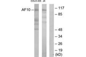 Western blot analysis of extracts from COLO205/Jurkat cells, using AF10 Antibody. (MLLT10 anticorps  (AA 211-260))