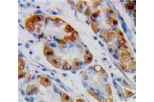 Used in DAB staining on fromalin fixed paraffin-embedded Stomach tissue